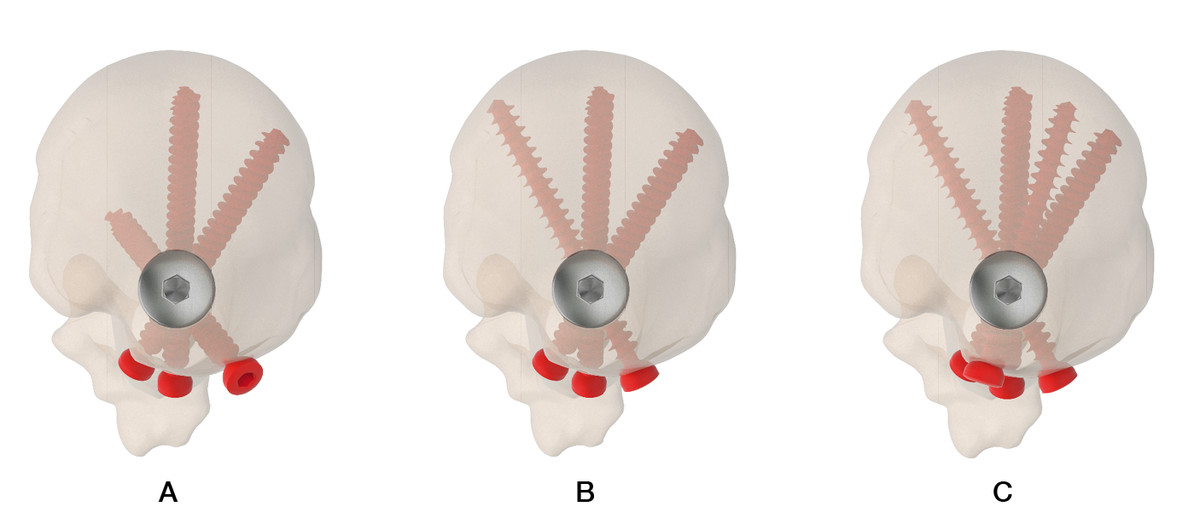 Image for 